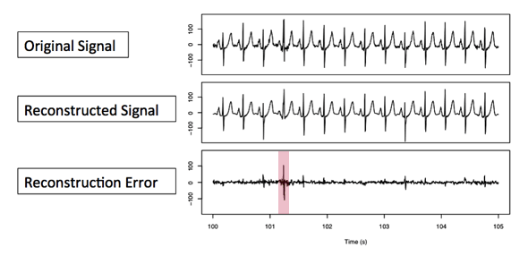 Anomaly detection in EKG data. The difference in the comparison between original signal being tested and the prototype reconstructed from the dictionary of shapes is the reconstruction error, the clue to anomalies in the original signal.